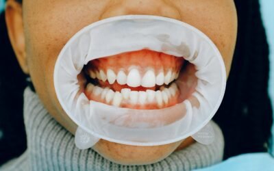 Homeopathic Remedies for Mouth Sores and Oral Health During Cancer Therapy